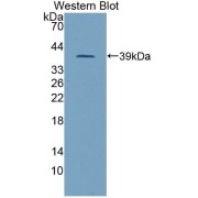 Western blot analysis of the recombinant protein.