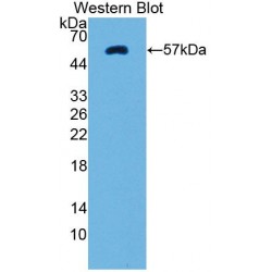 Protein Tyrosine Kinase 2 Beta (PTK2b) Antibody