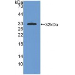 Protein Kinase C Iota (PKCi) Antibody