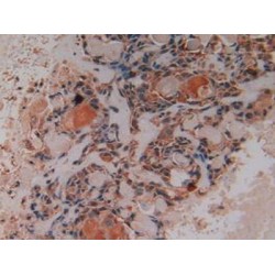 Protein Kinase C Iota (PKCi) Antibody