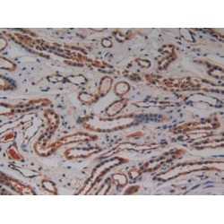 Protein Kinase C Iota (PKCi) Antibody