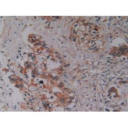 Protein Kinase C Iota (PKCi) Antibody