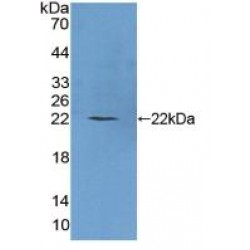 Phospholipase C Beta 1, Phosphoinositide Specific (PLCb1) Antibody