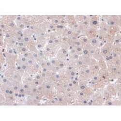 Phospholipase C Beta 1, Phosphoinositide Specific (PLCb1) Antibody