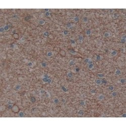 Phospholipase C Eta 1 (PLCh1) Antibody