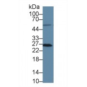 Western blot analysis of Human HT1080 cell lysate, using Human MSRA Antibody (3 µg/ml) and HRP-conjugated Goat Anti-Rabbit antibody (<a href="https://www.abbexa.com/index.php?route=product/search&amp;search=abx400043" target="_blank">abx400043</a>, 0.2 µg/ml).