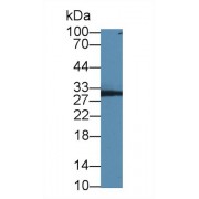 Western blot analysis of Human Jurket cell lysate, using Rat NP Antibody (3 µg/ml) and HRP-conjugated Goat Anti-Rabbit antibody (<a href="https://www.abbexa.com/index.php?route=product/search&amp;search=abx400043" target="_blank">abx400043</a>, 0.2 µg/ml).