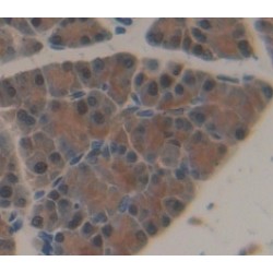 Neuropathy Target Esterase (PNPLA6) Antibody