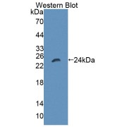 Western blot analysis of the recombinant protein.