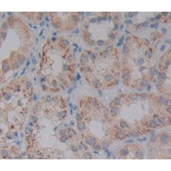 Pyruvate Dehydrogenase Phosphatase 2 (PDP2) Antibody