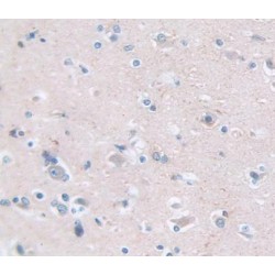 Proenkephalin A (PENK) Antibody