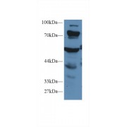 Western blot analysis of Mouse Liver lysate, using Human PCCa Antibody (1 µg/ml) and HRP-conjugated Goat Anti-Rabbit antibody (<a href="https://www.abbexa.com/index.php?route=product/search&amp;search=abx400043" target="_blank">abx400043</a>, 0.2 µg/ml).