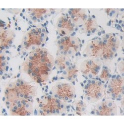 Propionyl-CoA Carboxylase Alpha Chain, Mitochondrial (PCCA) Antibody