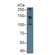 Western blot analysis of Human HeLa cell lysate, using Human PCM1 Antibody (1 µg/ml) and HRP-conjugated Goat Anti-Rabbit antibody (<a href="https://www.abbexa.com/index.php?route=product/search&amp;search=abx400043" target="_blank">abx400043</a>, 0.2 µg/ml).
