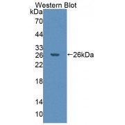 Western blot analysis of recombinant Mouse PTPN21 Protein.
