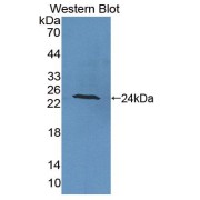 Western blot analysis of the recombinant protein.