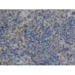 Protein Tyrosine Phosphatase Receptor Type A (PTPRA) Antibody