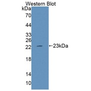 Western blot analysis of the recombinant protein.