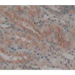 Receptor-Type Tyrosine-Protein Phosphatase Epsilon (PTPRE) Antibody