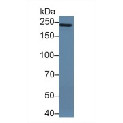 Western blot analysis of Human A549 cell lysate, using Mouse PTPRZ Antibody (2 µg/ml) and HRP-conjugated Goat Anti-Rabbit antibody (<a href="https://www.abbexa.com/index.php?route=product/search&amp;search=abx400043" target="_blank">abx400043</a>, 0.2 µg/ml).