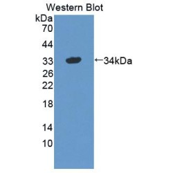 Protein Tyrosine Phosphatase, Non Receptor Type 5 (PTPN5) Antibody