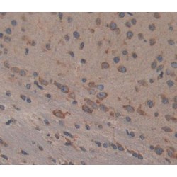 Protein Tyrosine Phosphatase, Non Receptor Type 5 (PTPN5) Antibody