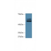 Western blot analysis of Human HL60 cell lysate, using Human PTPN5 Antibody (1 µg/ml) and HRP-conjugated Goat Anti-Rabbit antibody (<a href="https://www.abbexa.com/index.php?route=product/search&amp;search=abx400043" target="_blank">abx400043</a>, 0.2 µg/ml).