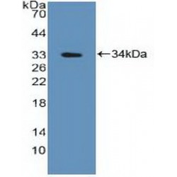 Protein Tyrosine Phosphatase, Non Receptor Type 2 (PTPN2) Antibody