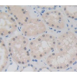 Protein Tyrosine Phosphatase, Non Receptor Type 2 (PTPN2) Antibody