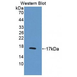 Ubiquinol Cytochrome C Reductase Binding Protein (UQCRB) Antibody