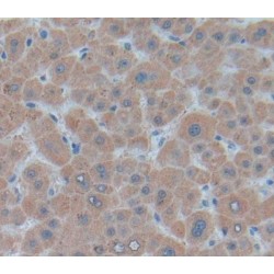 Ubiquinol Cytochrome C Reductase Binding Protein (UQCRB) Antibody