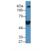 Western blot analysis of Human K562 cell lysate, using Human ALDH1A2 Antibody (1 µg/ml) and HRP-conjugated Goat Anti-Rabbit antibody (<a href="https://www.abbexa.com/index.php?route=product/search&amp;search=abx400043" target="_blank">abx400043</a>, 0.2 µg/ml).