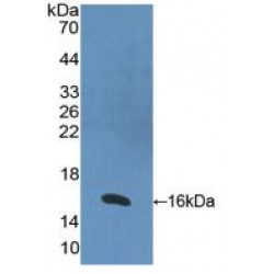 Retinoic Acid Receptor Alpha (RARa) Antibody