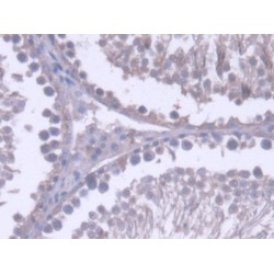 Ribonuclease H2 Subunit A (RNASEH2A) Antibody