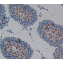 Ribonuclease H2 Subunit A (RNASEH2A) Antibody