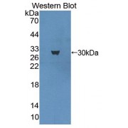 Western blot analysis of recombinant Human MECP2.