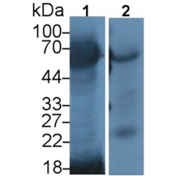 Methyl CpG Binding Protein 2 (MECP2) Antibody