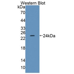 Acyl Coenzyme A Dehydrogenase, C2-To-C3 Short Chain (ACADS) Antibody