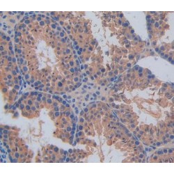 Calcium Activated Nucleotidase 1 (CANT1) Antibody