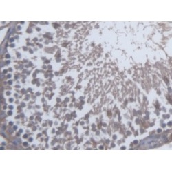 Src Kinase Associated Phosphoprotein 1 (SKAP1) Antibody