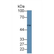 Western blot analysis of Human Leukocyte lysate, using Rat MARCO Antibody (1 µg/ml) and HRP-conjugated Goat Anti-Rabbit antibody (<a href="https://www.abbexa.com/index.php?route=product/search&amp;search=abx400043" target="_blank">abx400043</a>, 0.2 µg/ml).