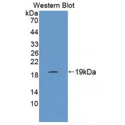 Macrophage Receptor With Collagenous Structure (MARCO) Antibody
