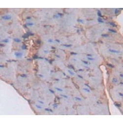 Succinate Dehydrogenase Complex Subunit A (SDHA) Antibody