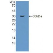Western blot analysis of recombinant Human HSD17b3.