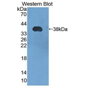 Western blot analysis of the recombinant protein.