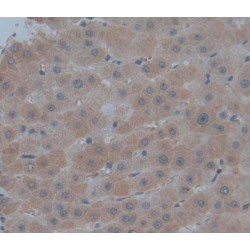 Phosphomannomutase 1 (PMM1) Antibody