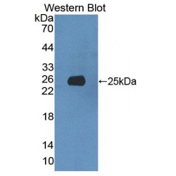 5'-3'Exoribonuclease 1 (XRN1) Antibody