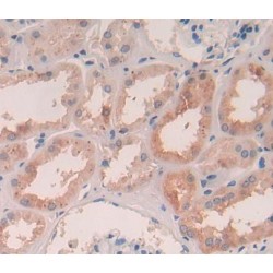 Pim-3 Oncogene (PIM3) Antibody
