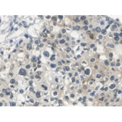 Squamous Cell Carcinoma Antigen (SCCA1/A2) Antibody