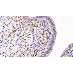 Pigment Epithelium-Derived Factor / PEDF (SERPINF1) Antibody